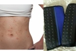 Những tác hại nếu sử dụng đai nịt bụng kém chất lượng thường xuyên