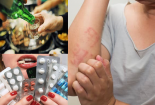 Những bất lợi khi dùng thuốc chống dị ứng Diphenhydramin cùng với rượu