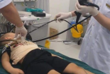 Que nhựa 10 cm mắc trong ruột cả tháng khiến bé trai đau quặn bụng phải nhập viện