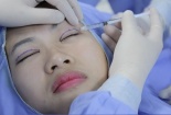 Những biến chứng sau bấm mí luồn chỉ chị em nên biết để cân nhắc