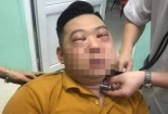Tác dụng phụ nguy hiểm của hành tây ít ai ngờ