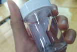 Cứu bé trai bị móc dây kéo lọt vào vị trí nhạy cảm suốt 2 tháng
