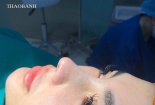 Trào lưu livestream phẫu thuật thẩm mỹ tràn ngập mạng xã hội