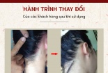 Bộ sản phẩm Da liễu mập mờ tiêu chuẩn chất lượng vẫn quảng cáo ‘ngập’ chợ mạng