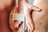 Những thói quen hàng ngày gây tổn thương cho tĩnh mạch