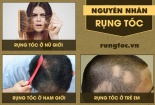 Loạn quảng cáo sản phẩm chữa tóc bạc sớm, rụng tóc