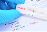 Sản phẩm test nhanh Covid -19 không thuộc danh mục hàng hóa, dịch vụ thực hiện bình ổn giá 