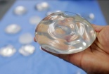 FDA cảnh báo về nâng ngực: Nhiều rủi ro tiềm ẩn, bao gồm cả loại bệnh ung thư hiếm gặp