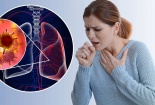 WHO cảnh báo các loại thực phẩm gây ung thư hàng đầu nên tránh