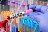 WHO cảnh báo Omicron gây 'nguy cơ rất cao' toàn cầu