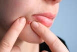 Cảnh báo có thể tử vong nếu nặn mụn ở những vị trí 'tử thần' này