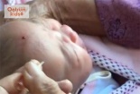 Trẻ sơ sinh nguy kịch do nhờ thầy lang chích đẹn
