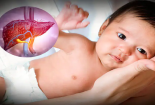 Sở Y tế TP.HCM khuyến cáo về dịch viêm gan cấp gây tử vong ở trẻ em