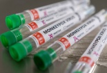 Phát triển bộ kit test nhanh virus đậu mùa khỉ