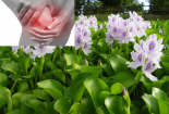 Cảnh báo: Đắp bèo tây chữa viêm khớp, bệnh tình nghiêm trọng thêm