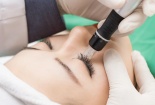 Cấy mi sinh học không thực sự hiệu quả như quảng cáo