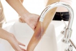 Nhiều trẻ bị nhiễm trùng nặng do đắp thuốc lá trị bỏng