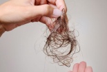 Lưu ý khi sử dụng thuốc trị rụng tóc minoxidil 
