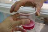 Suýt mất mạng do uống nhầm methadone 