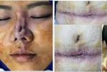 Cẩn trọng 'rước họa vào thân' khi làm đẹp đón Tết