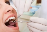 Nguy cơ 'gặp họa' khi sử dụng thuốc tẩy trắng răng 