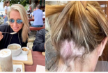Sản phẩm chăm sóc tóc của Olaplex bị nghi có chứa thành phần gây hói