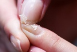 Dấu hiệu bệnh lý từ tình trạng móng tay dễ bị gãy