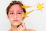 Những cách chăm sóc da bị cháy nắng hiệu quả