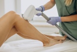 Triệt lông bằng laser nguy cơ gặp tác dụng phụ không mong muốn