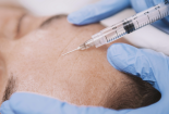 Cảnh giác trước những quảng cáo thổi phồng về dịch vụ tiêm filler làm đẹp để lại hậu quả khó lường