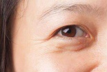 Sử dụng kem dưỡng mắt: Lưu ý thành phần đặc hiệu để đảm bảo an toàn và hiệu quả