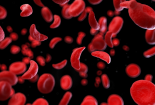 Nước đầu tiên trên thế giới cấp phép sử dụng liệu pháp gene để trị bệnh thiếu máu do di truyền