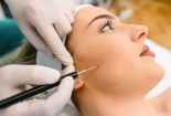 Cẩn trọng trước nhiều biến chứng nguy hiểm sau khi xăm nốt ruồi son  