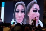 Những nguyên nhân khiến biến chứng thẩm mỹ ngày càng gia tăng