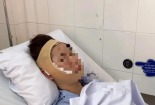 Nữ TikToker nổi tiếng đưa ra lời cảnh báo sau 6 năm tiêm filler: Cẩn trọng khi lựa chọn cơ sở thẩm mỹ