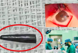 Khuyến cáo trẻ nhỏ cần thận trọng khi chơi các vật sắc nhọn