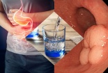 Dùng nước ion kiềm để trị ung thư - Cách đi nhanh hơn đến cửa tử