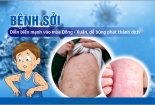 Dịch sởi đang tăng cao, người dân cần chủ động phòng tránh