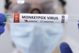 WHO cấp phép sử dụng vaccine phòng bệnh đậu mùa khỉ thứ hai