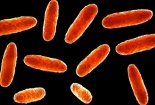 Cảnh báo nguy cơ sức khoẻ do nhiễm vi khuẩn Klebsiella oxytoca