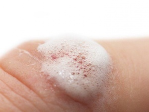 Chuyên gia y tế cảnh báo lạm dụng oxy già sát trùng vết thương có thể gây hại sức khỏe