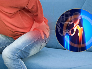 Rượu bia, thuốc lá đẩy người trẻ đối mặt nguy cơ tàn phế vì hoại tử chỏm xương đùi