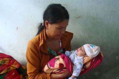 Cứu sống trẻ sinh non dị tật ống tiêu hóa, viêm phổi nặng