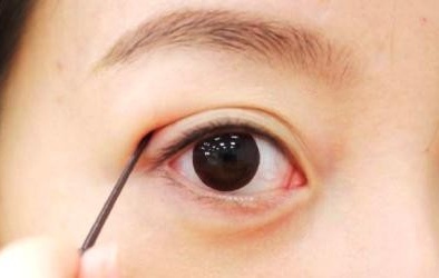 Hãi hùng chiêu căng mắt bằng... chỉ dạng keo