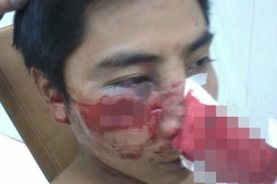 141 Công an Hà Nội: "Kiếm củi 3 năm thiêu 1 giờ"