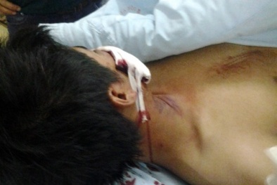 Công an Hà Nội kết luận lực lượng 141 không đánh người