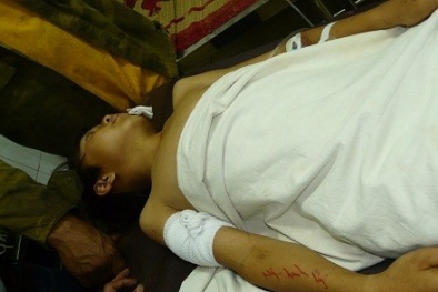 Nổ mìn làm 8 học sinh thương vong