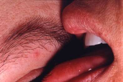 Dễ mù lòa vì trào lưu liếm tròng mắt