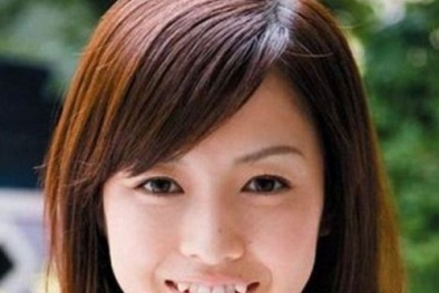 Ẩn họa trồng...răng khểnh