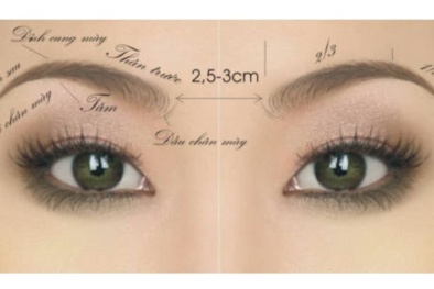 Sứt sẹo vì cắt treo chân mày